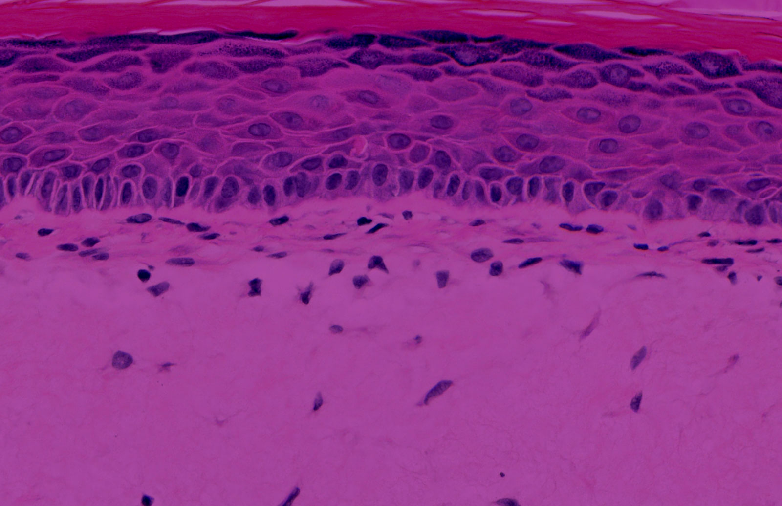 EpiDermFT™