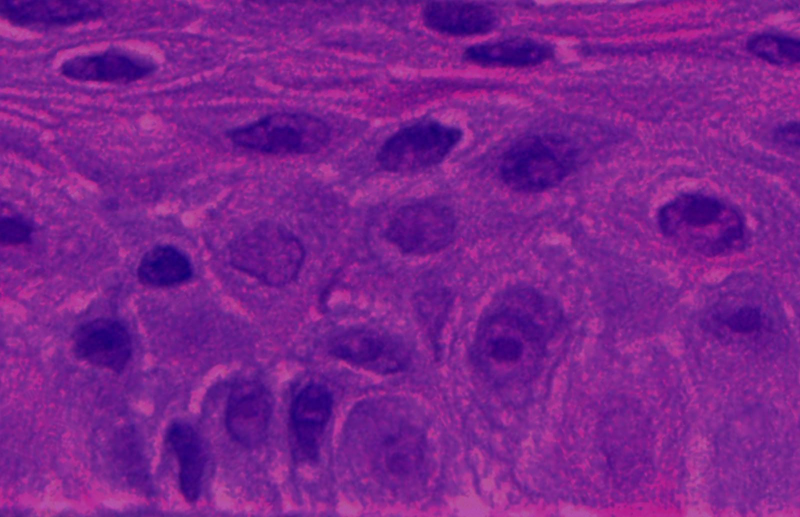 EpiOcular™